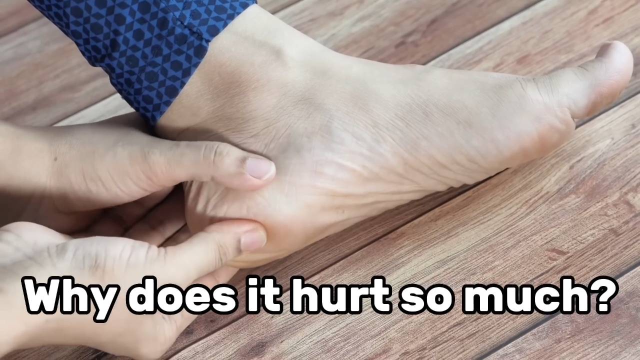 Plantar fasciitis causes and treatments 