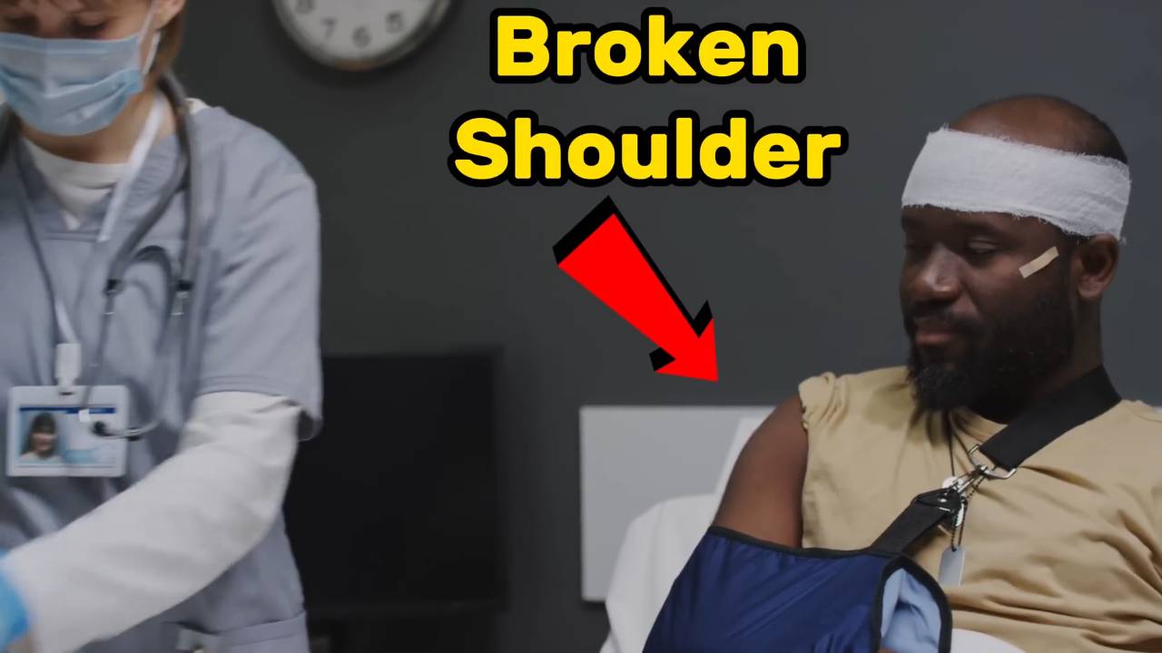 Shoulder fracture _ Causes and treatments 