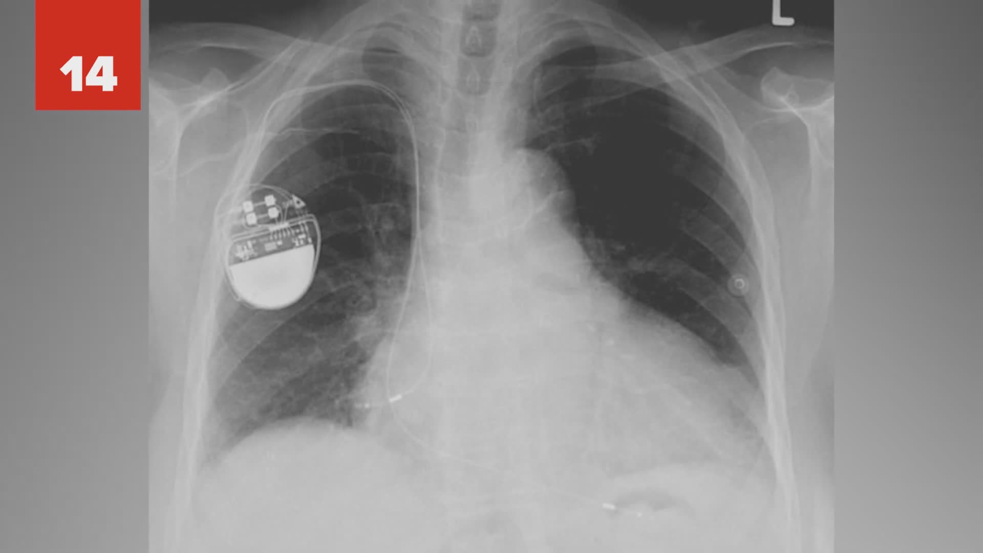 25 accidental inventions that changed the world