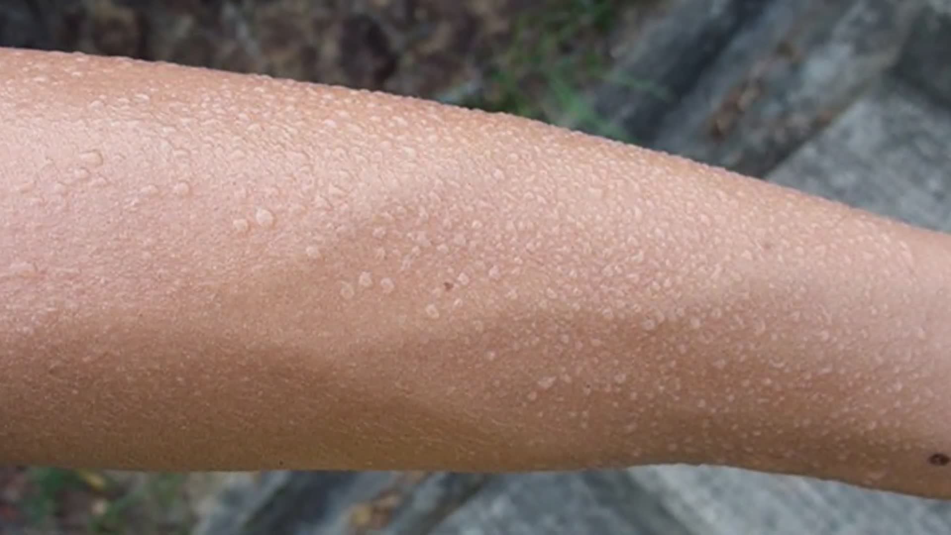 25 bacteria facts that might actually make you feel dirty