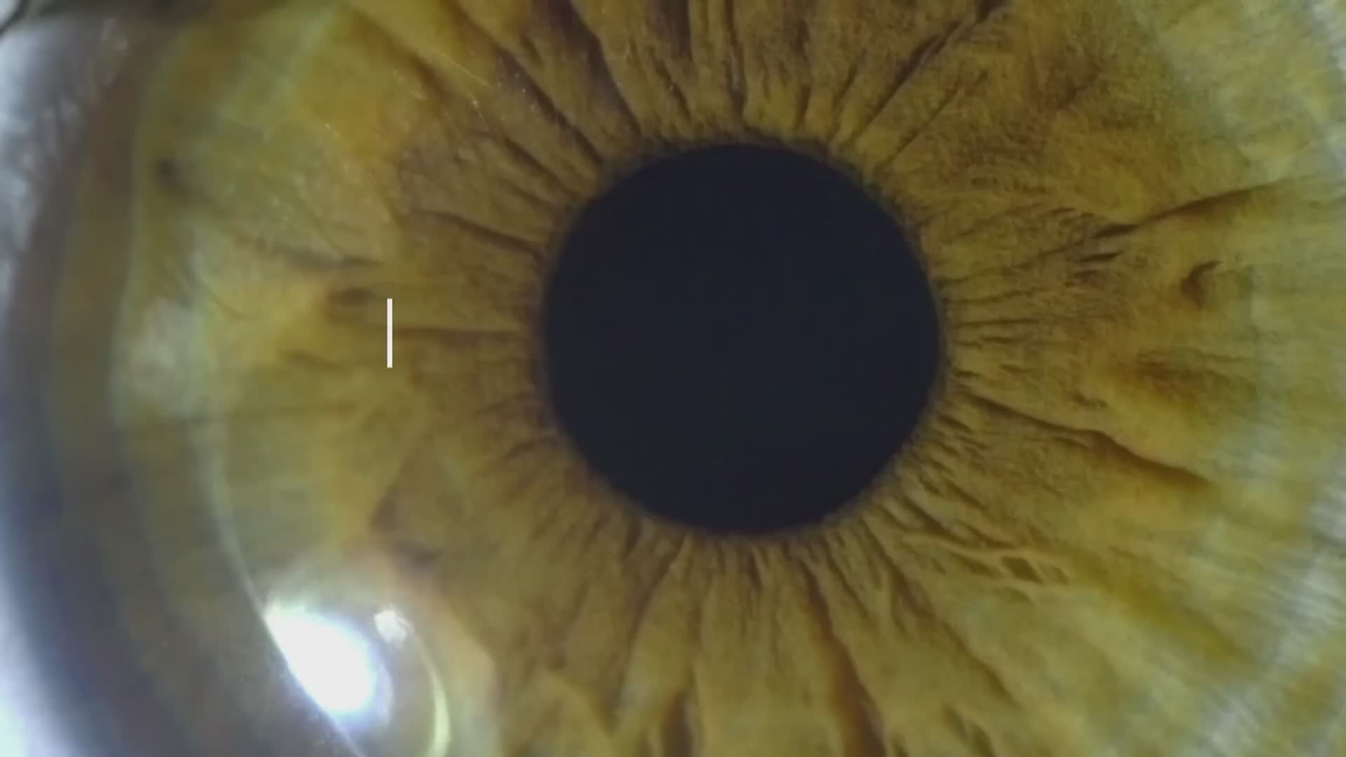 Are eye floaters and flashes dangerous or serious?