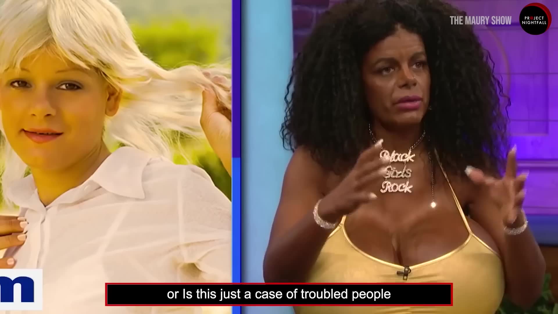 People undergoing surgery to appear as different ethnicity