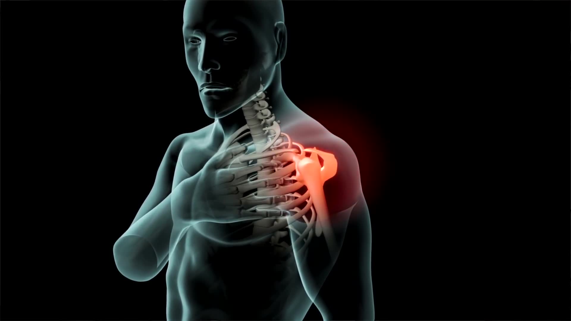 When degenerative joint disease requires total shoulder arthroplasty