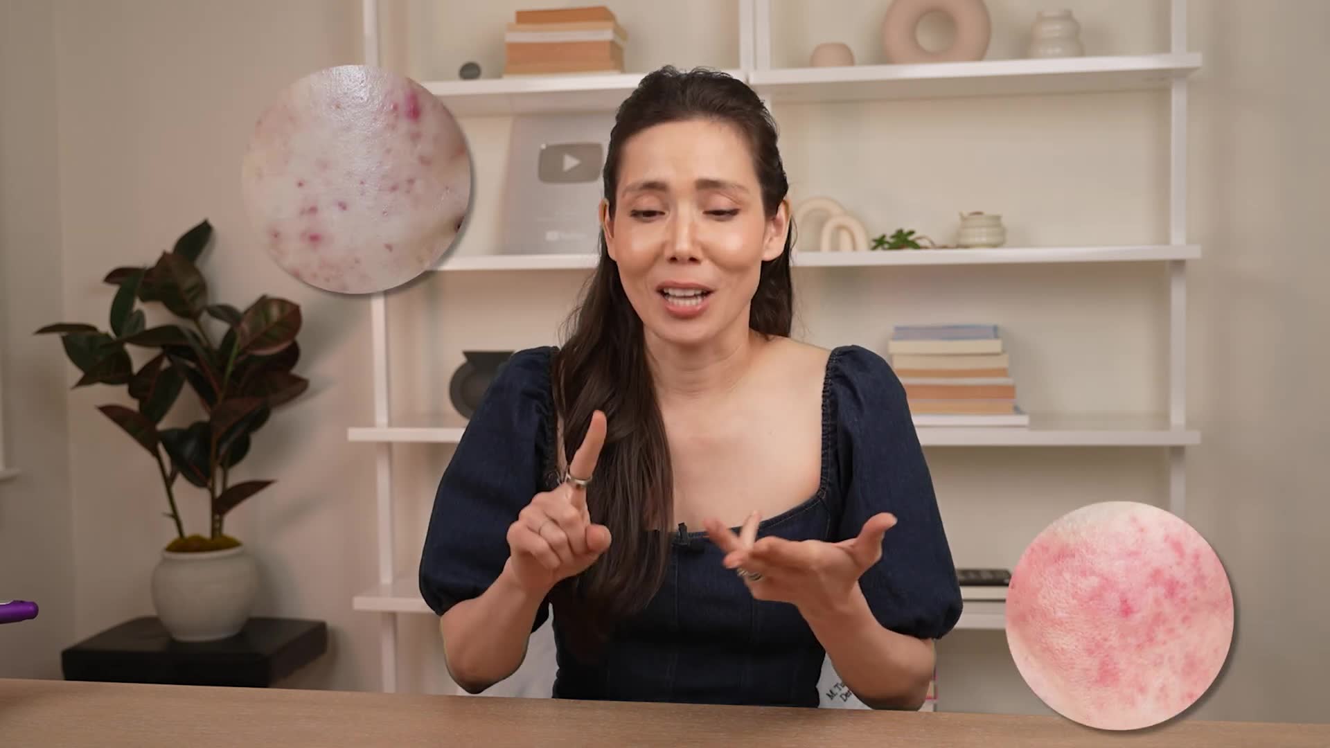 Ask a dermatologist instead of google sunscreen oil fungal acne much more