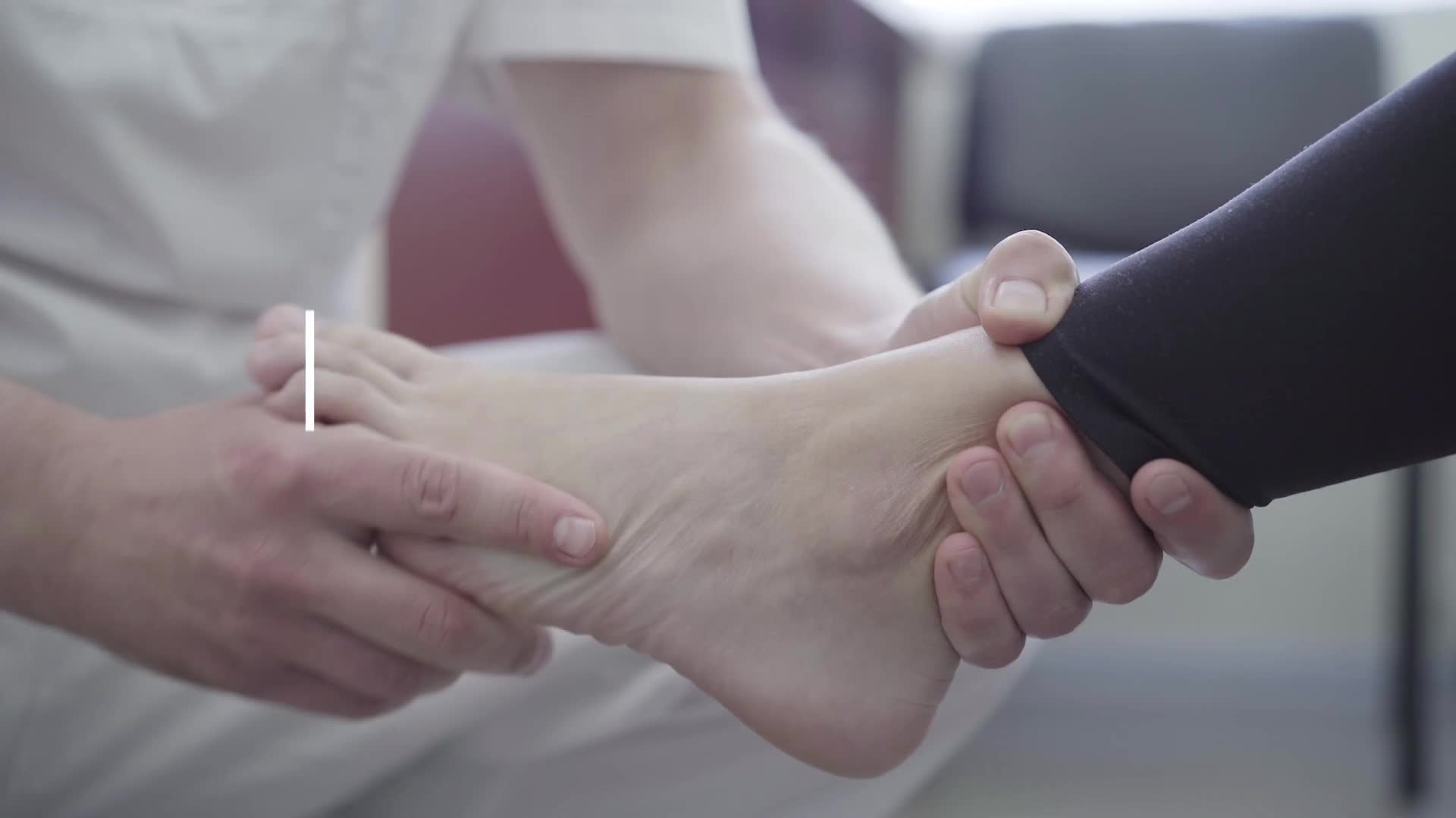 Complete tear of the heel tendon requiring surgical repair in athletes
