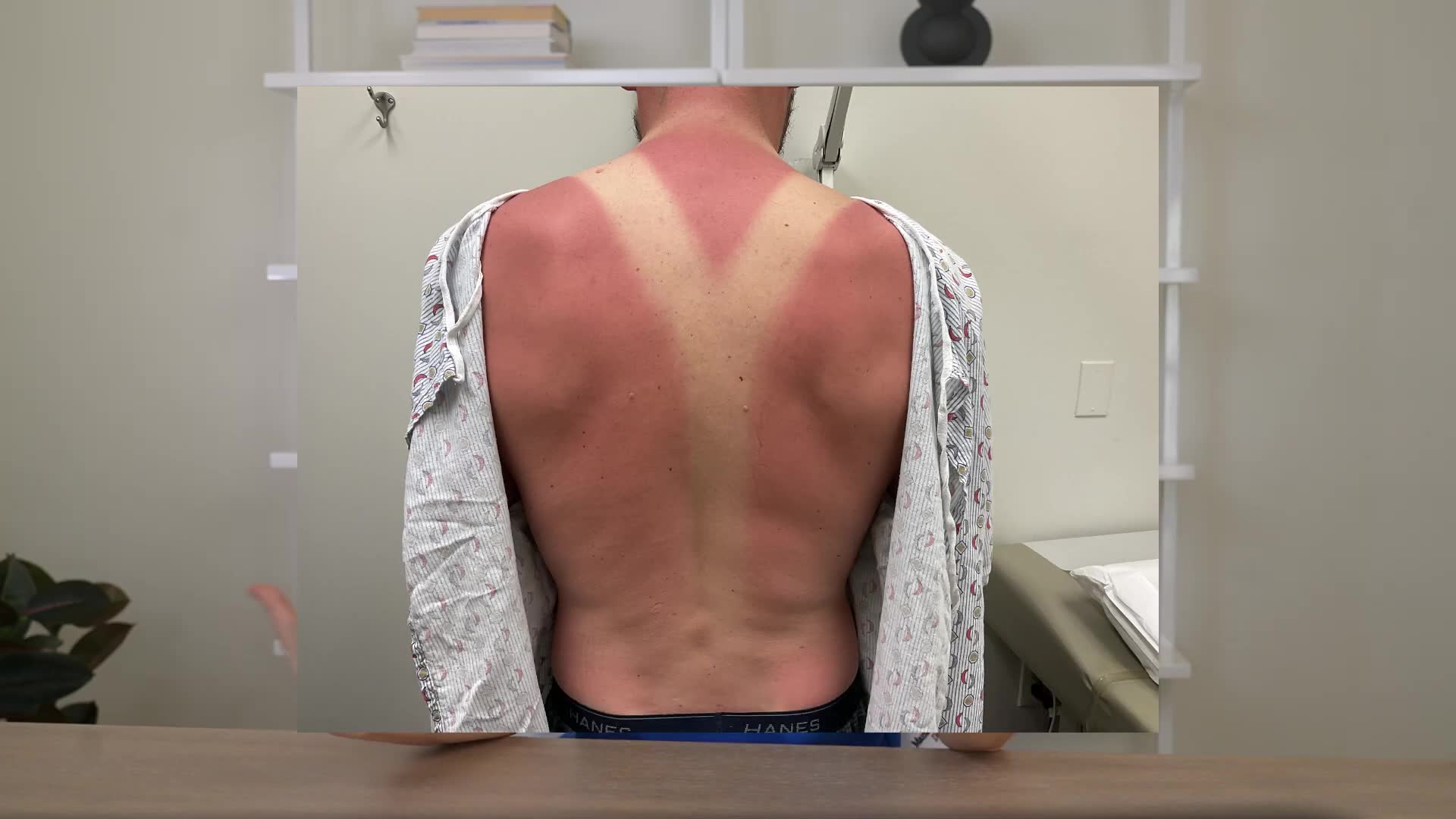 Sun protection mistakes you're making dermatologist reveals proper method
