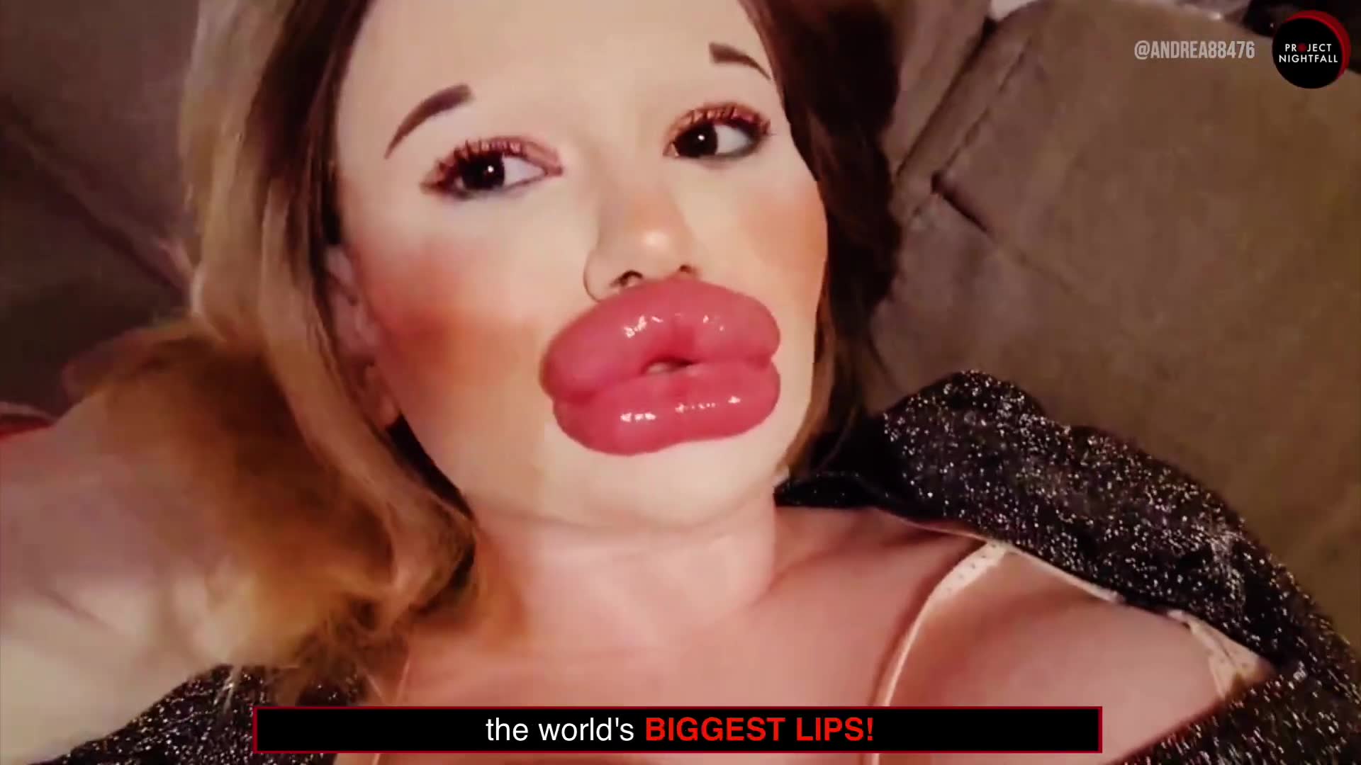 They took plastic surgery way too far and became unrecognizable