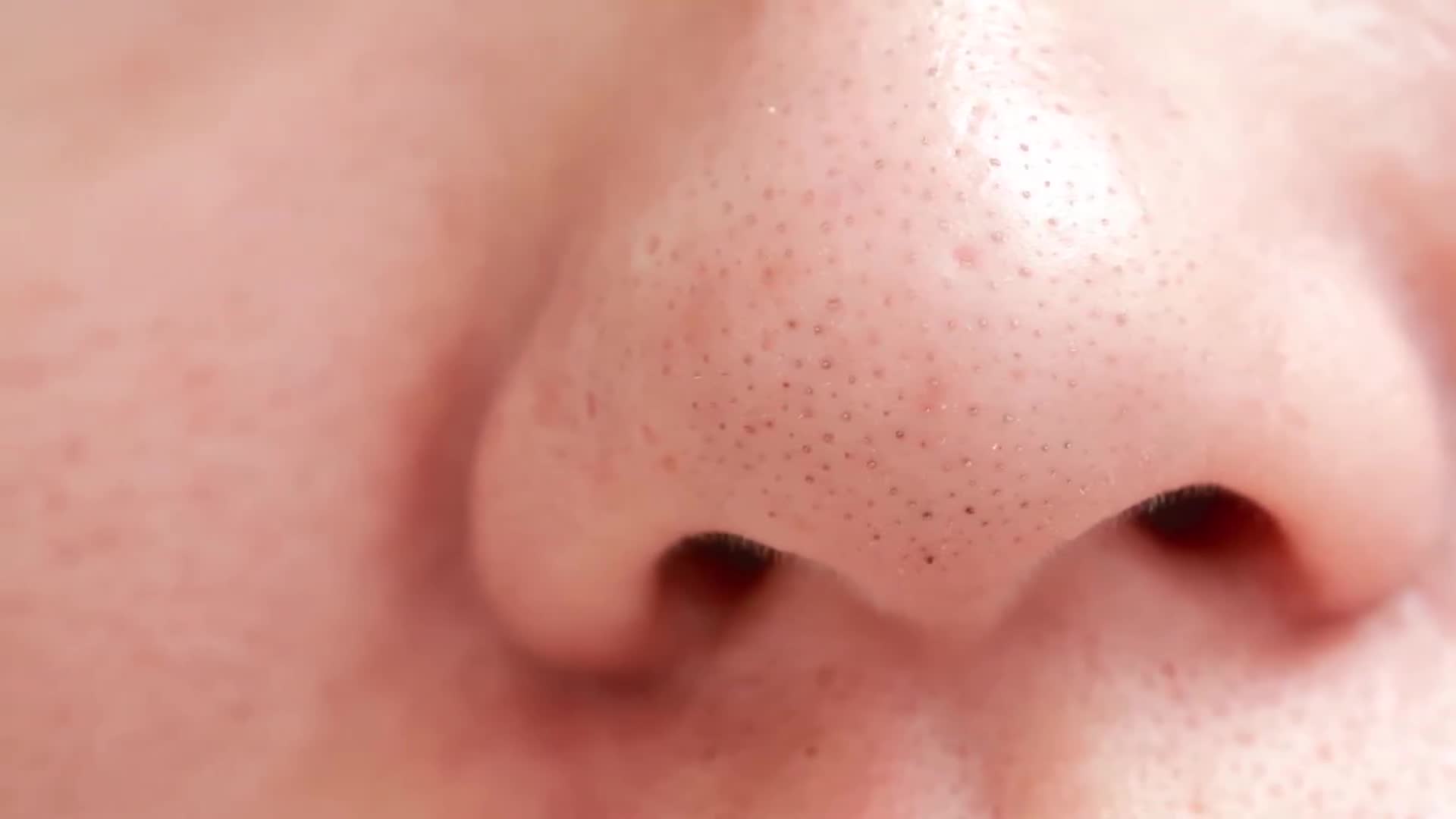 Remove nose blackheads properly dermatologist-approved extraction method