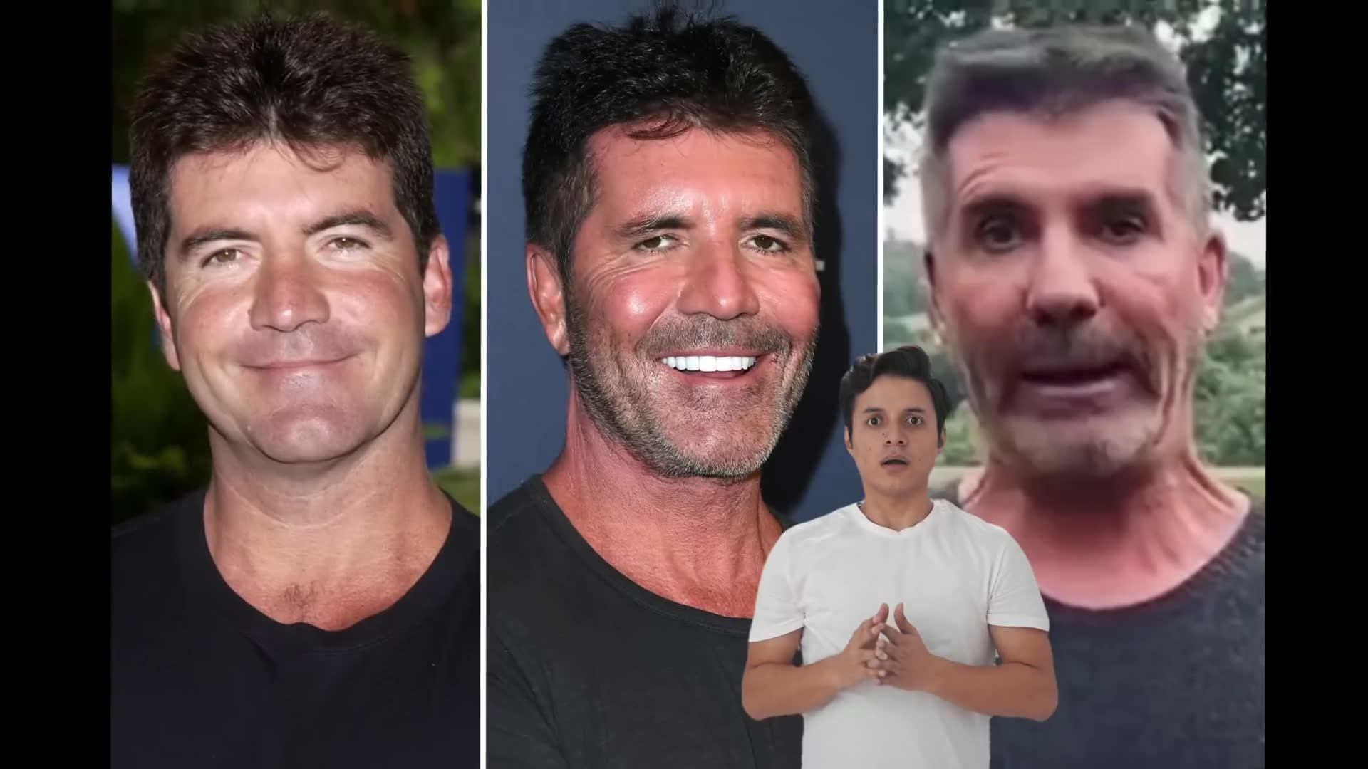 Professional analysis of celebrity facial cosmetic procedures
