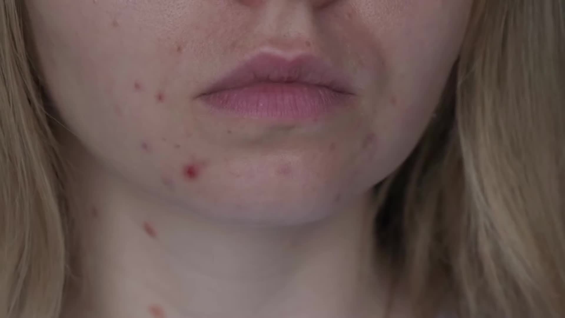 How stress reduction relates to skincare dermatologist connection explained
