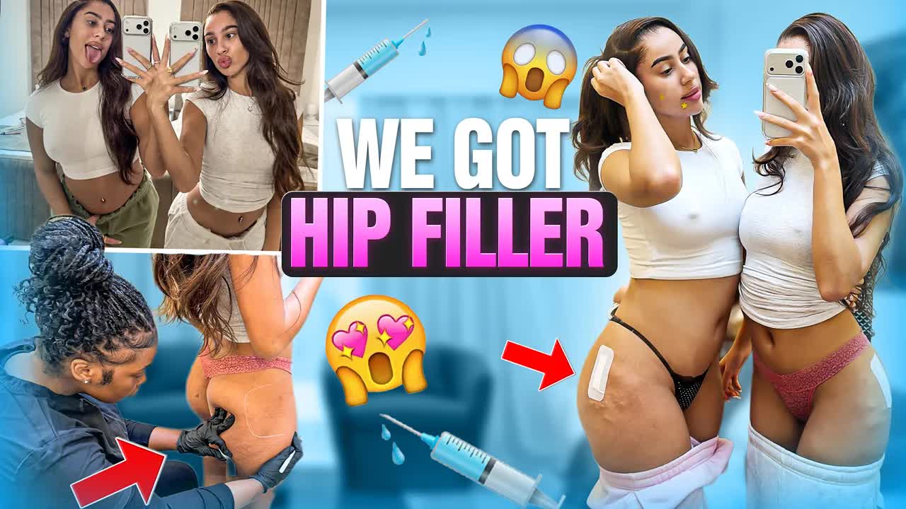 WE GOT HIP FILLER !