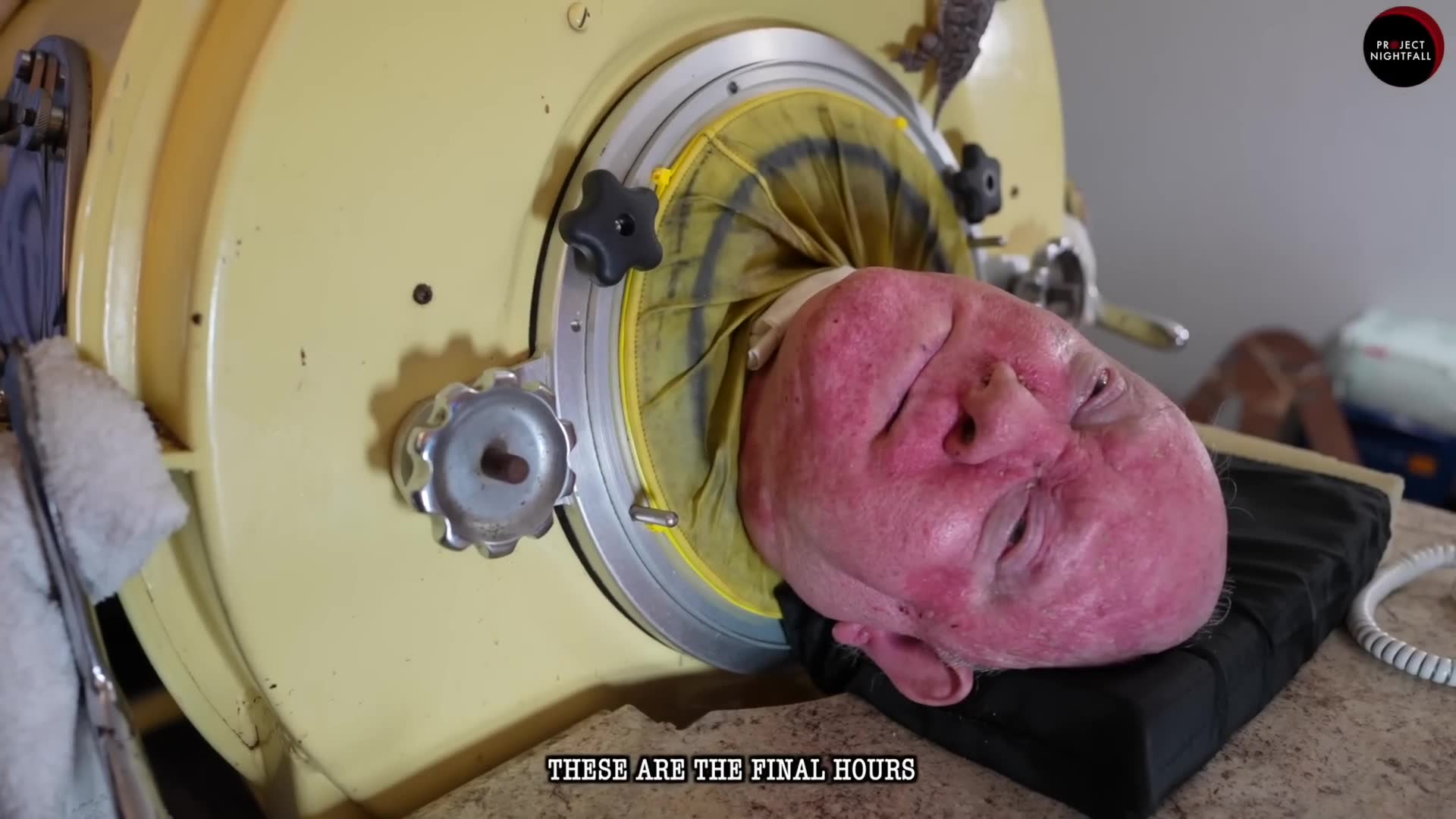 Medical mystery revealed after man survives 78 years living in iron lung