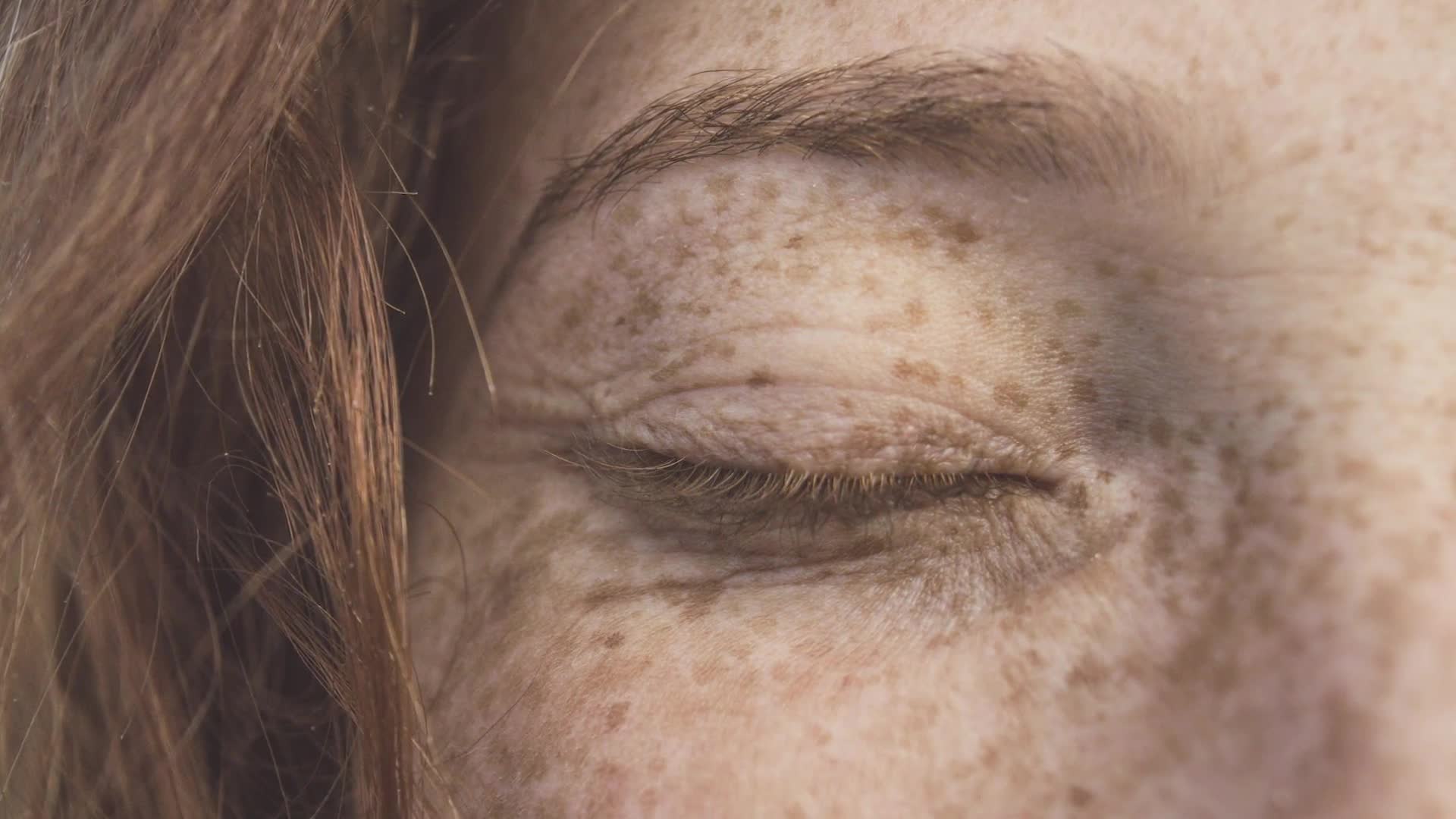 Evidence-based product recommendations for fading dark patches