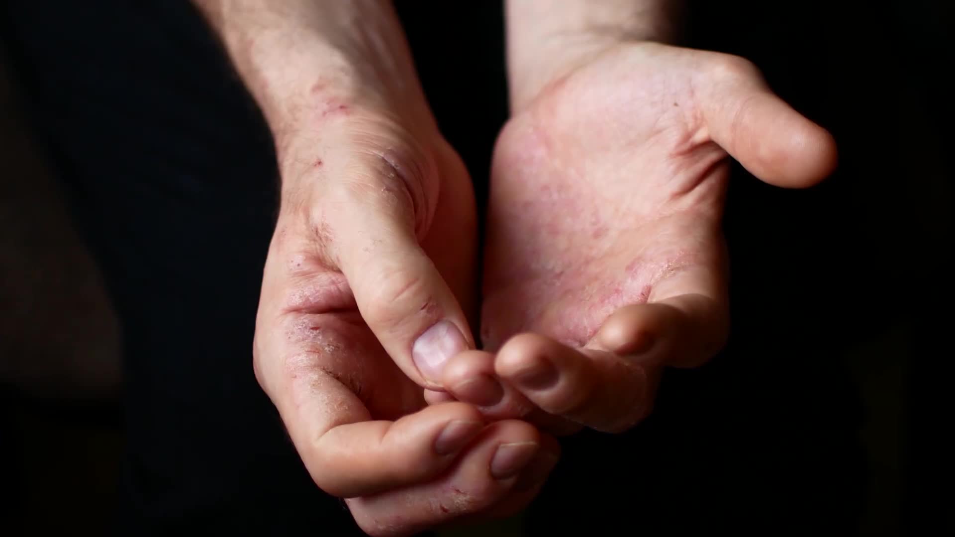 Professional recommendations for controlling inflammatory plaques