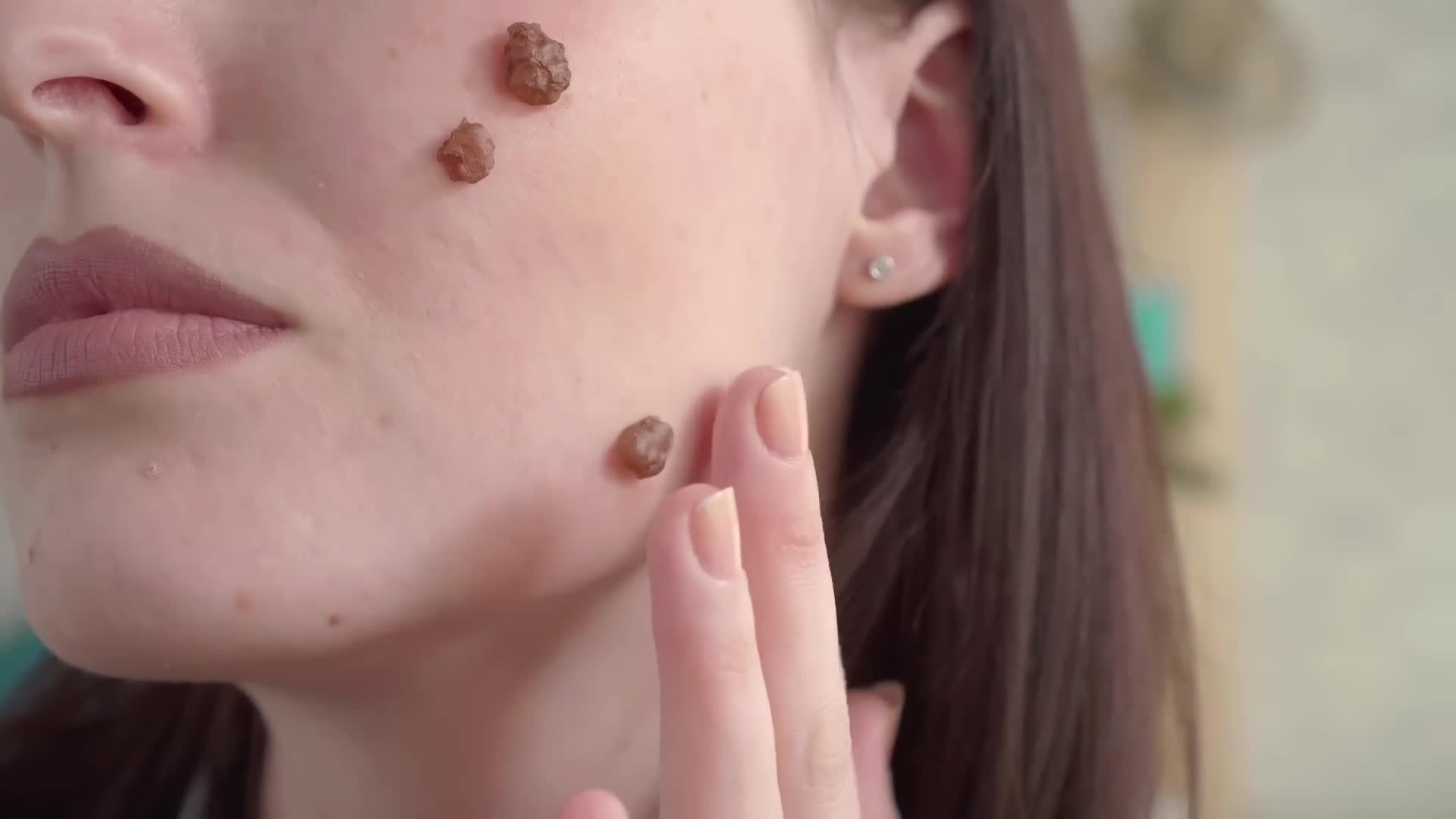 Skin cancer how to tell if you have it