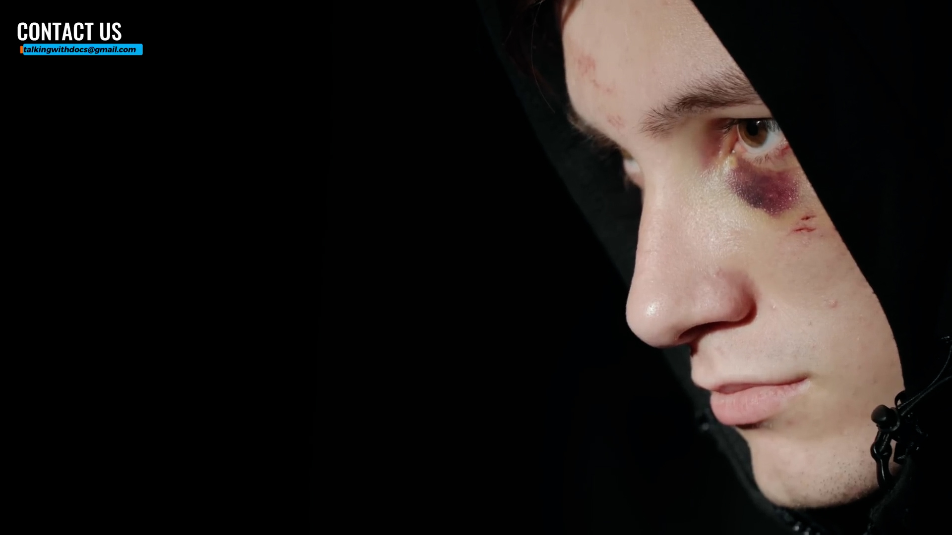 The subconjunctival hemorrhage warning signs doctors don't want you to ignore