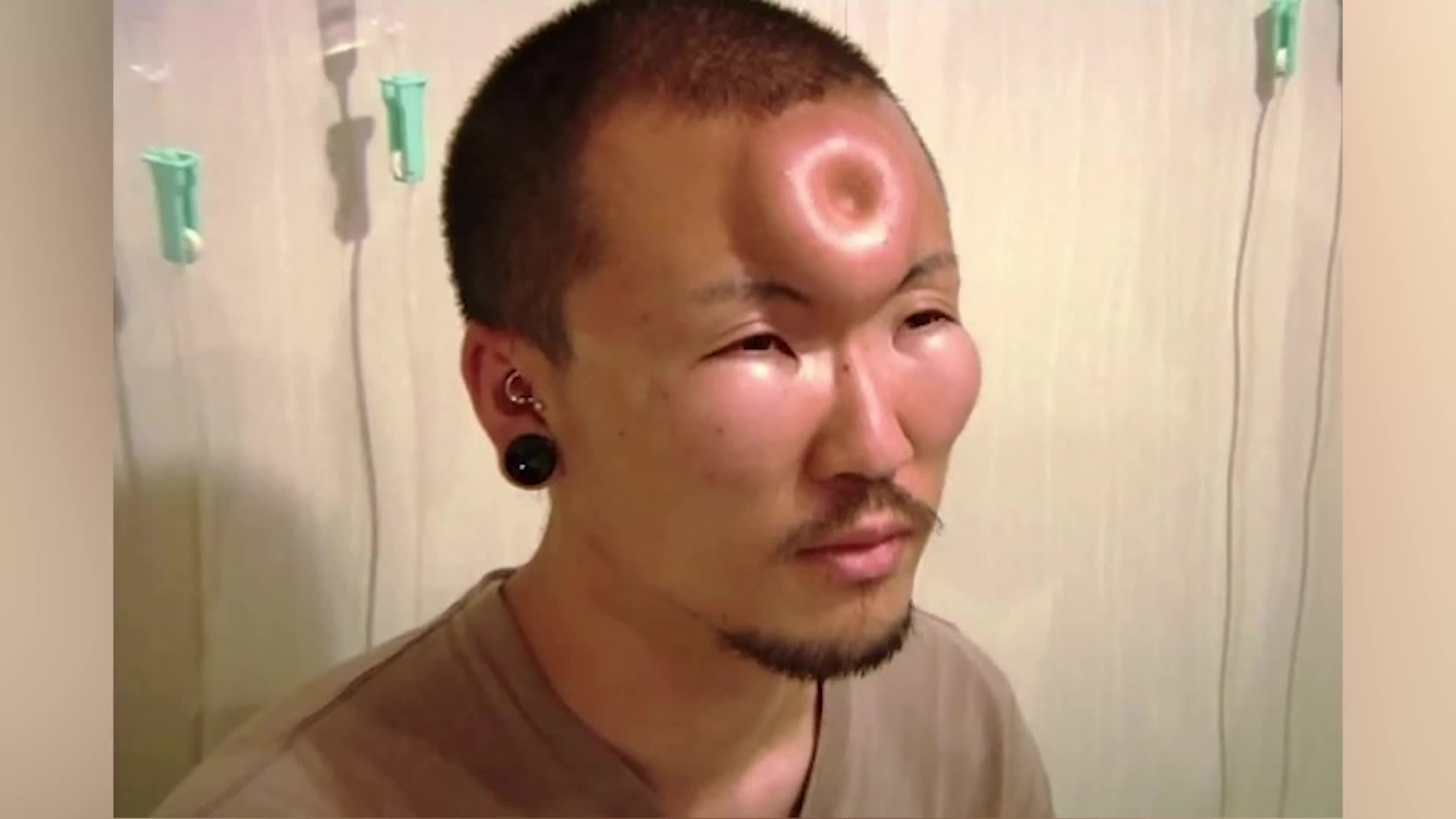 Pictures that make every viewer physically wince before they finish looking