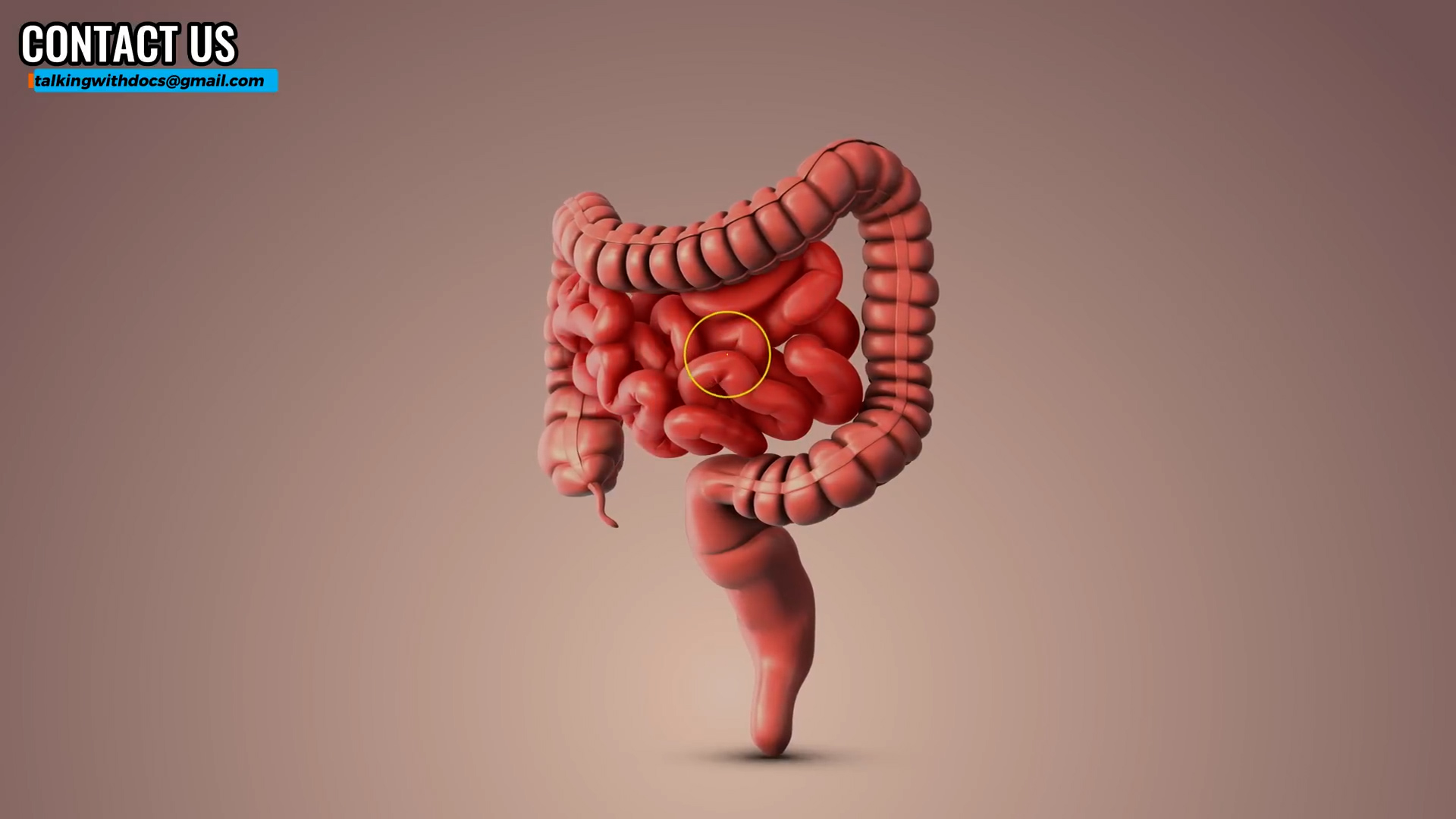 Doctors weigh in on doc has colonoscpy. things i wish and what actually works