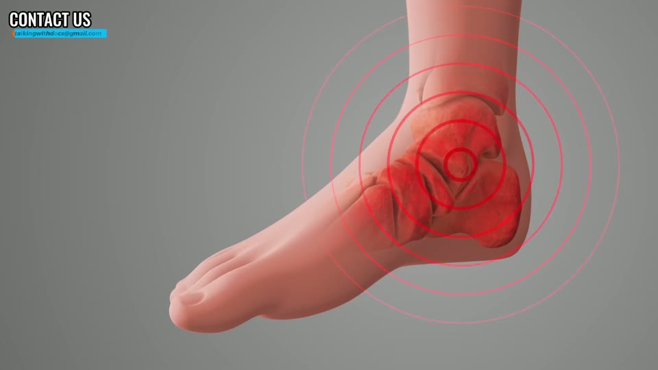 Orthopedic surgeons reveal the truth about ankle replacement or fusion best treatment