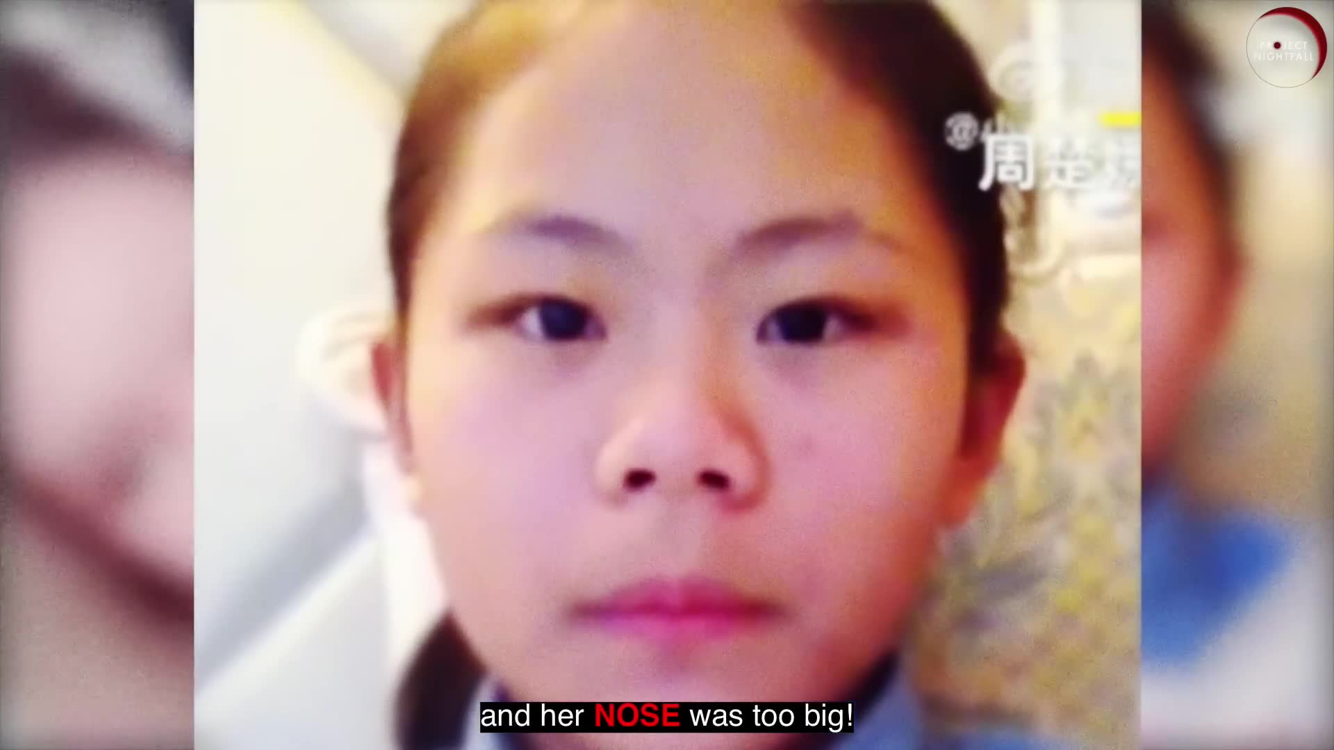Why this Chinese teen influencer had over 100 plastic surgeries