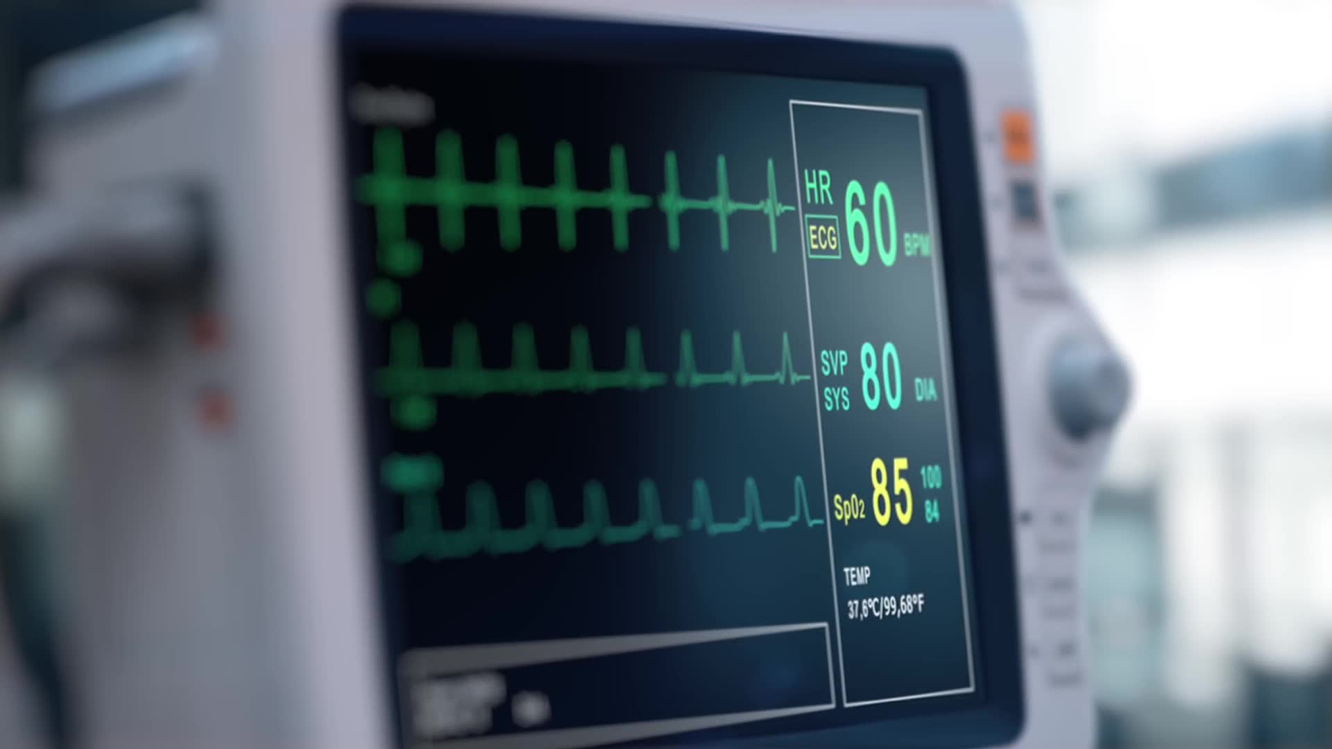 What cardiologists actually recommend for max heart rate formula