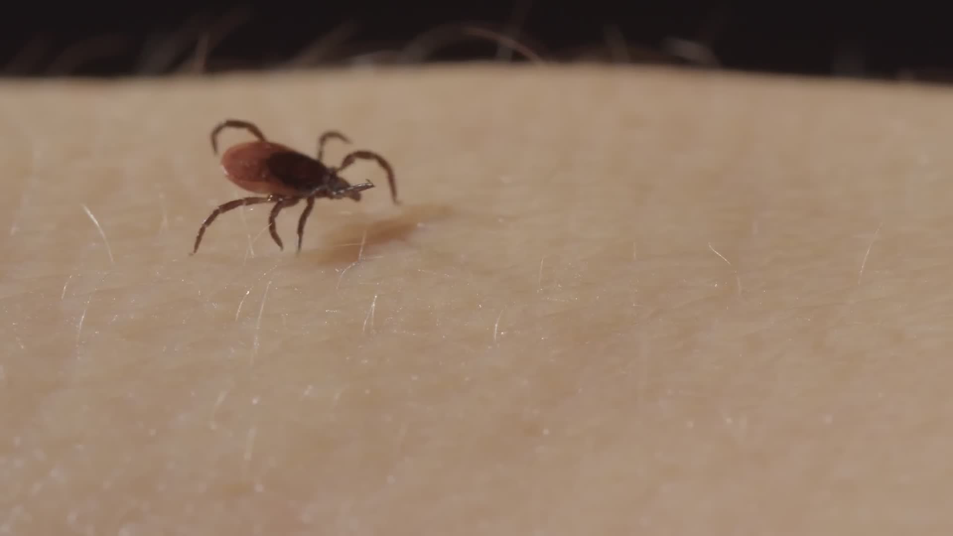 Lyme disease and ticks | Causes, treatments and more