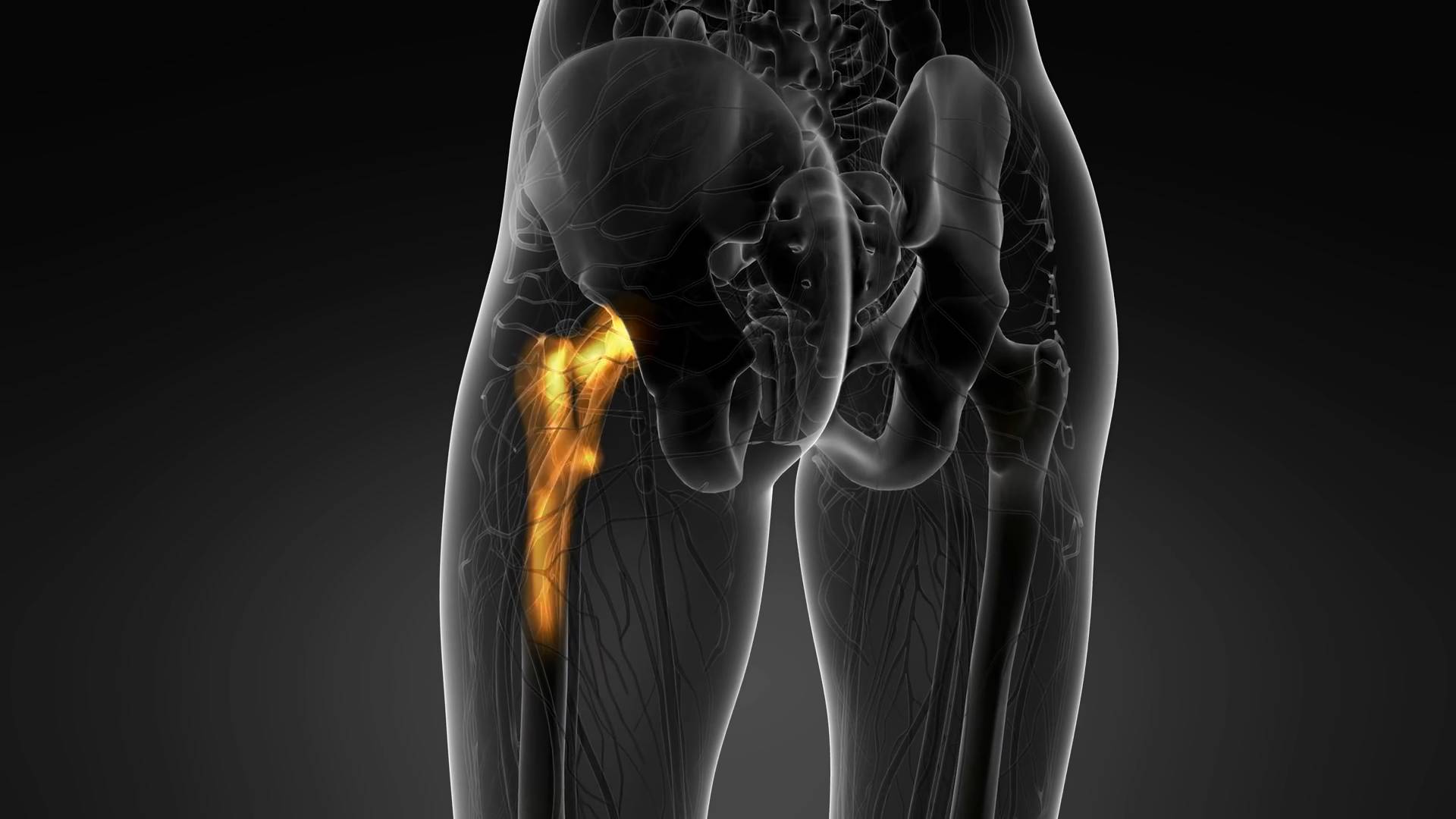 Fall prevention | 5 ways to protect yourself from fractures