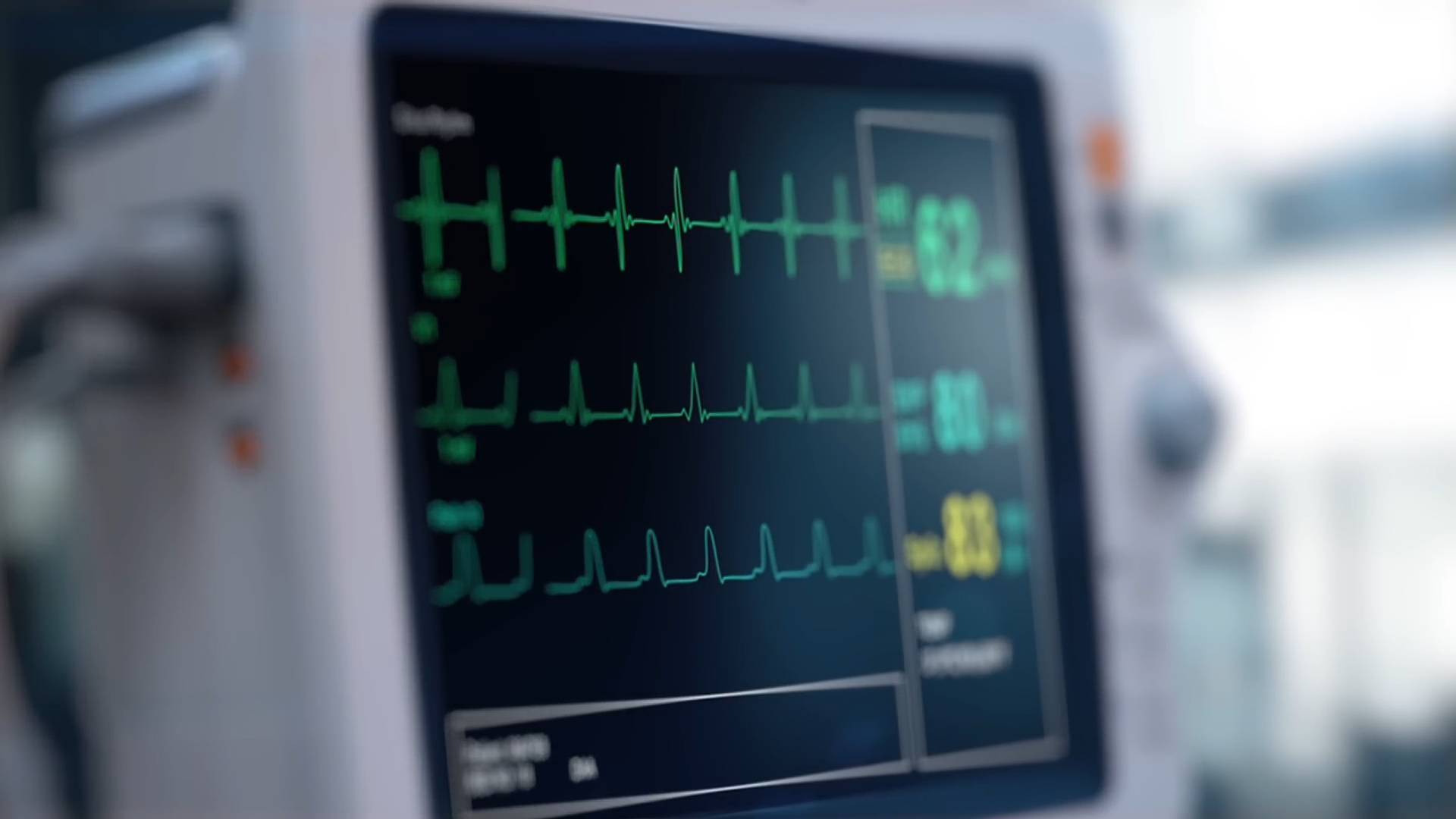 Doctors explain the real max heart rate formula